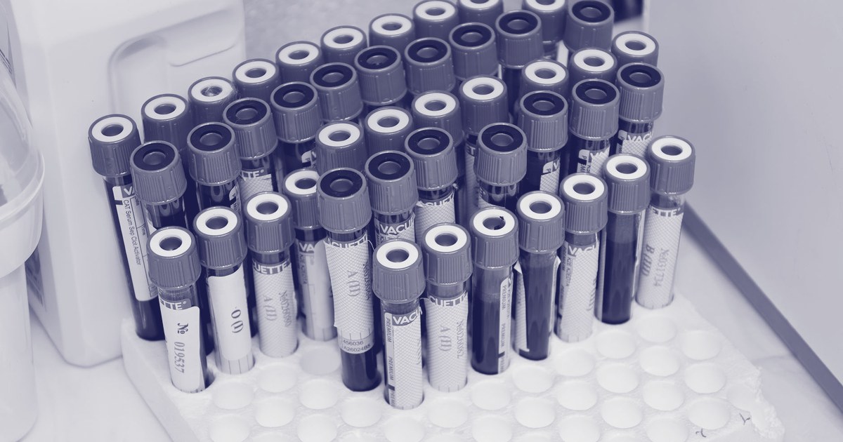 Rows of labeled specimen-collection tubes arranged in a laboratory rack, ready for testing