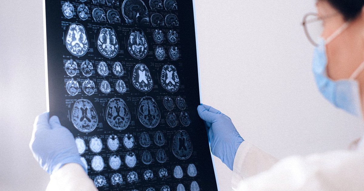 A clinician in surgical gloves holds up a full sheet of brain MRI scans against a plain wall