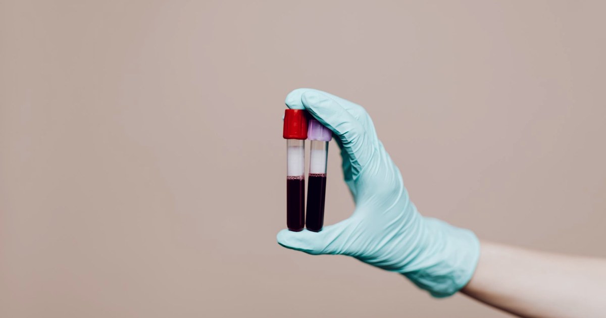 A gloved hand holding two lab sample vials, one with a red cap and one with a lavender cap, against a plain background